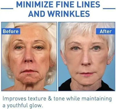 Botox Anti-Aging Serum(Pack Of 2)