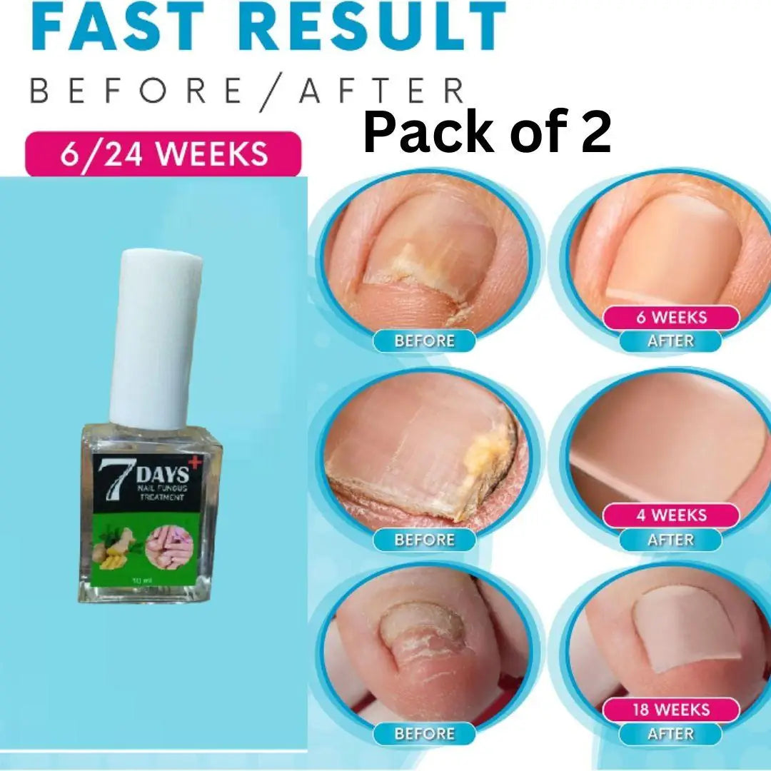 7 Days Nail Fungus Treatment Polish Pack Of 2