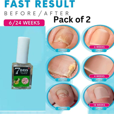 7 Days Nail Fungus Treatment Polish Pack Of 2